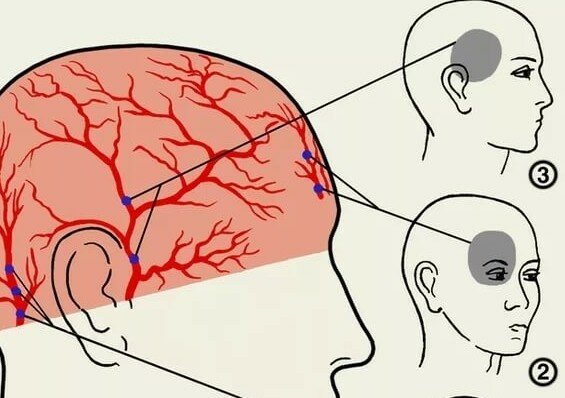 Болит голова больно глазами