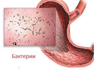 Болит голова тошнит болит живот и спина