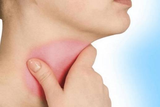 Болит горло и голова температуры нет лечение