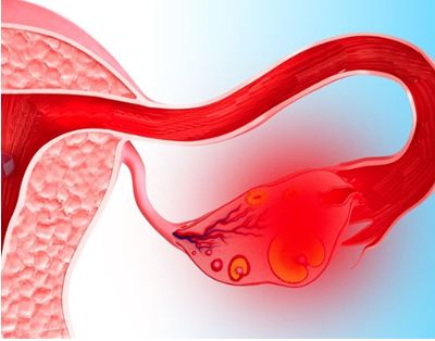 от чего может болеть спина после месячных