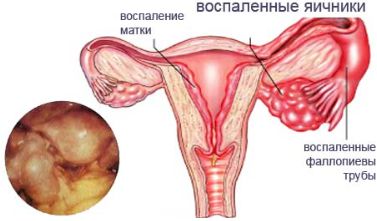от чего может болеть спина после месячных