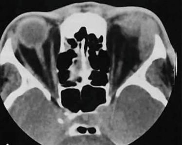 Температура болит спина ноги