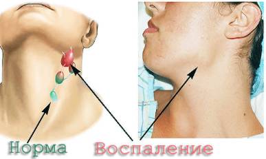 Температура болит спина ноги