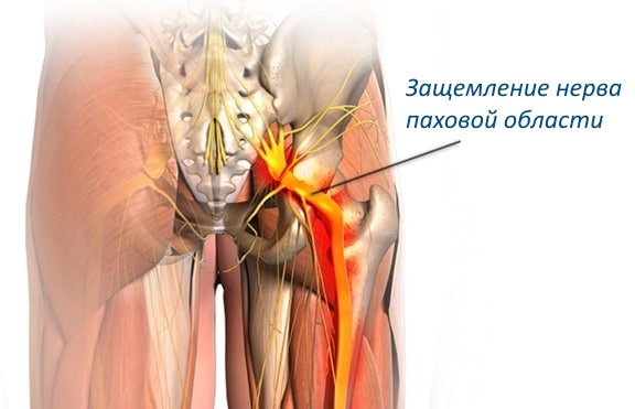 Болит слева спина поясница мужчина