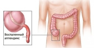Болит голова тошнит болит живот и спина
