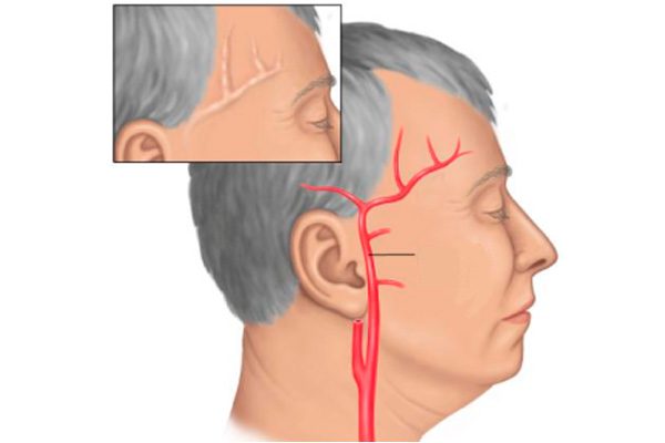 От чего болит голова и таблетки не помогают