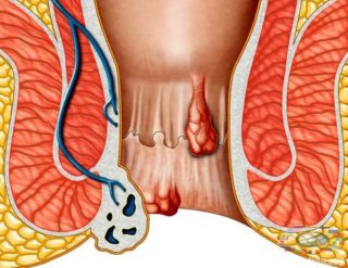 Когда болит со спины бок
