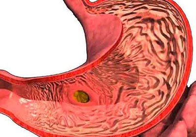 Болит голова тошнит болит живот и спина