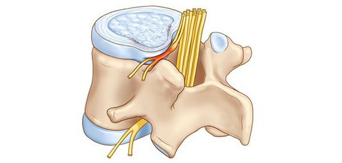 спина болит после приседа
