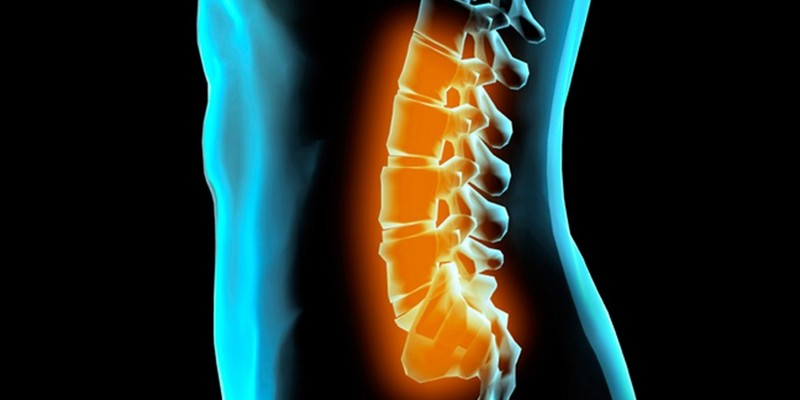 Смещение позвонков поясничного отдела - симптомы и лечение