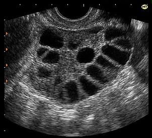 от чего может болеть спина после месячных