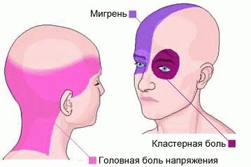 От чего болит голова и таблетки не помогают