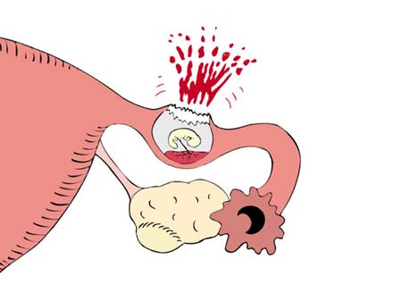 проблема труба